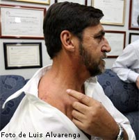 Polícia prende segundo suspeito do atentado